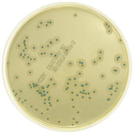 Medios cromogénicos para Listeria spp.