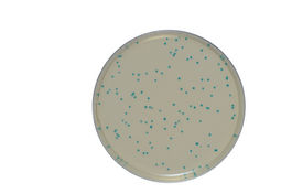 Medios cromogénicos para Listeria monocytogenes
